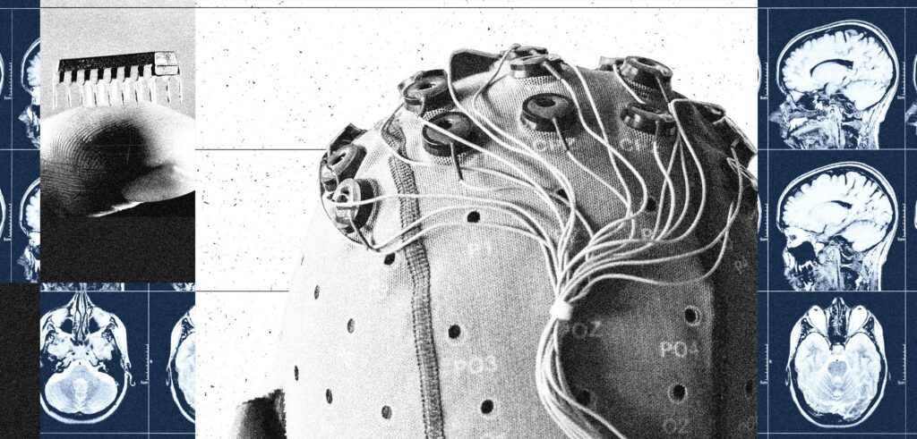 082025 Brain Computer Interfaces xsEGDp