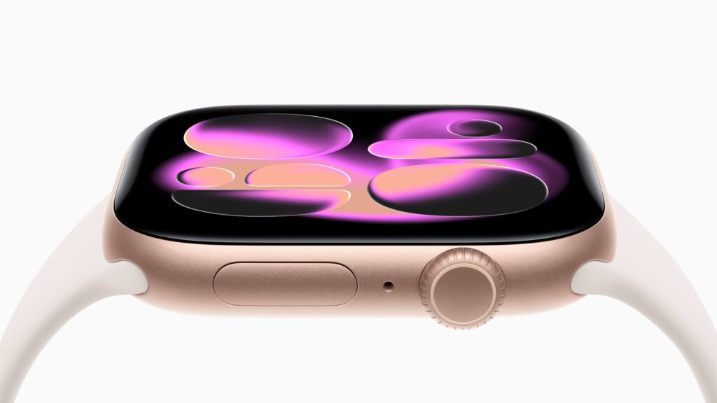 Apple Watch Series 11 hero 250909 CM1oai